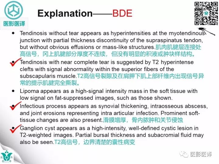 【病例】肩锁关节囊肿—喷泉征1例MR