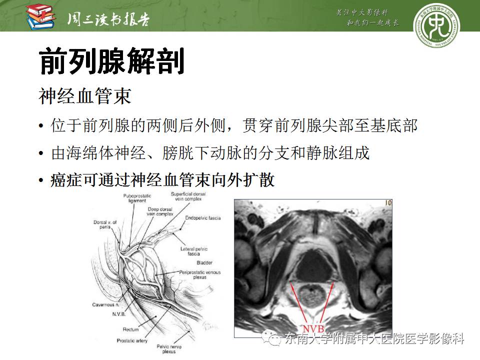 【PPT】超越前列腺腺癌：扩大前列腺病变MR鉴别诊断