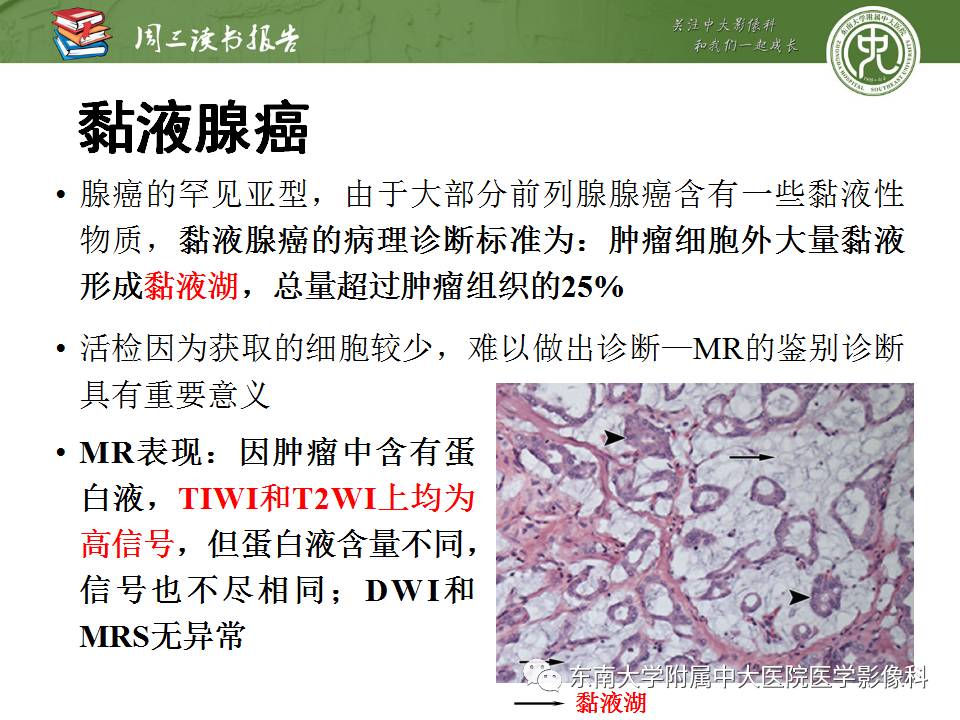 【PPT】超越前列腺腺癌：扩大前列腺病变MR鉴别诊断