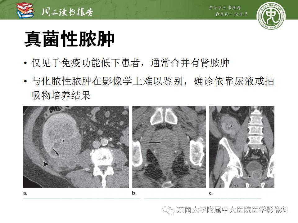 【PPT】超越前列腺腺癌：扩大前列腺病变MR鉴别诊断