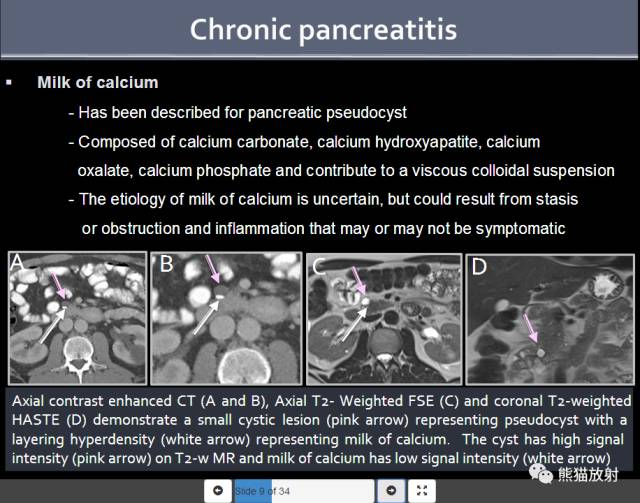 【PPT】胰腺含钙化肿物的CT诊断思路[双语]