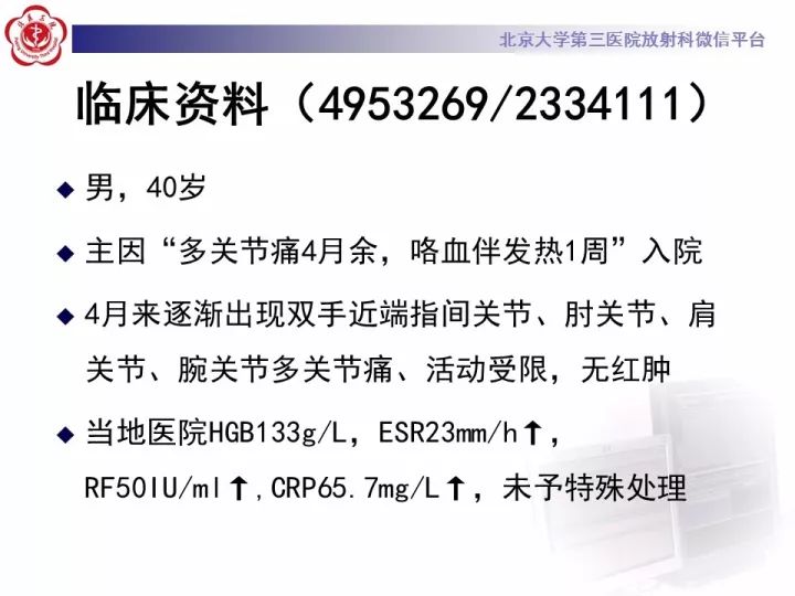 【病例】弥漫性肺泡出血1例CT影像表现