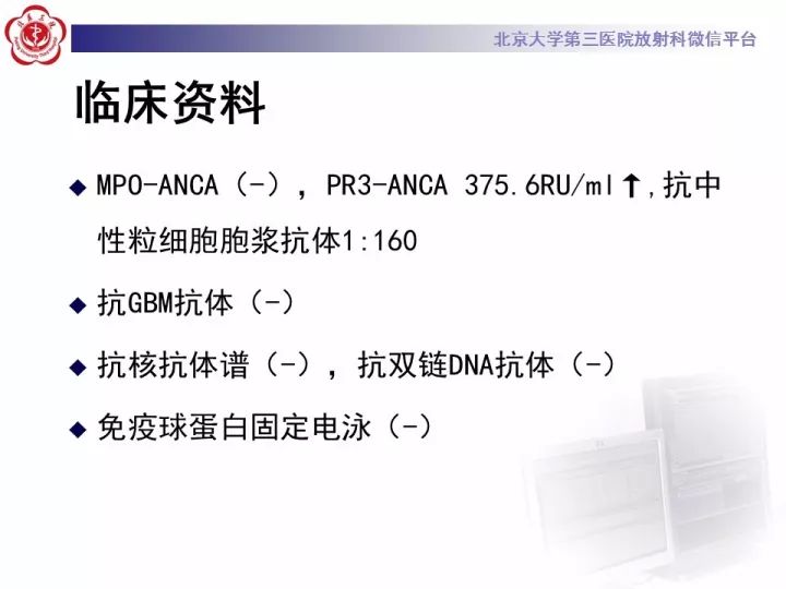 【病例】弥漫性肺泡出血1例CT影像表现