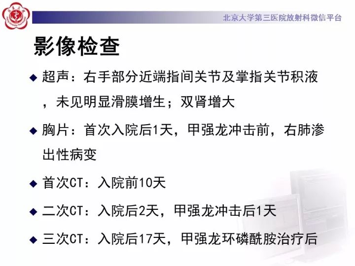 【病例】弥漫性肺泡出血1例CT影像表现