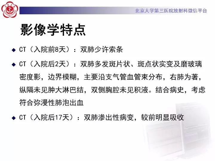 【病例】弥漫性肺泡出血1例CT影像表现