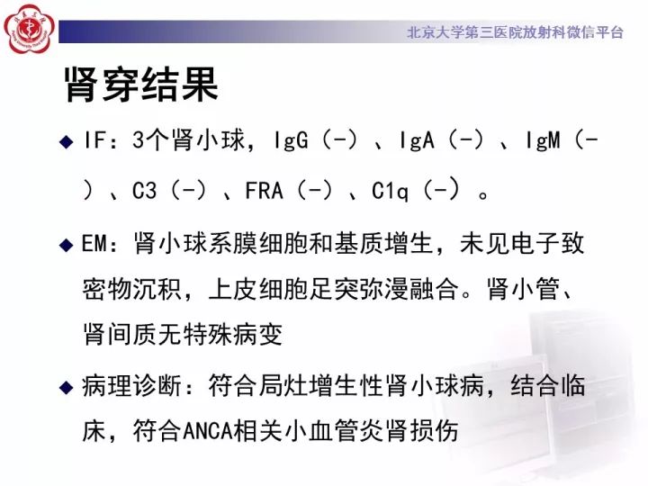 【病例】弥漫性肺泡出血1例CT影像表现