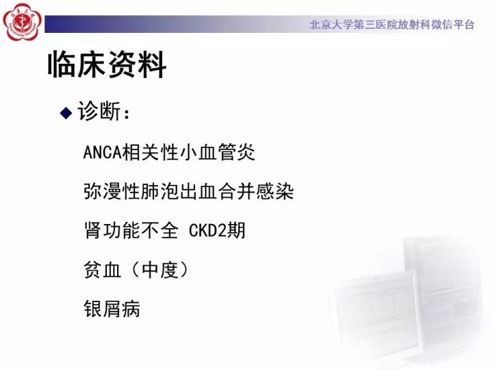 【病例】弥漫性肺泡出血1例CT影像表现