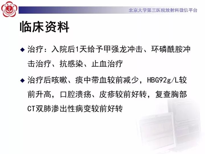 【病例】弥漫性肺泡出血1例CT影像表现