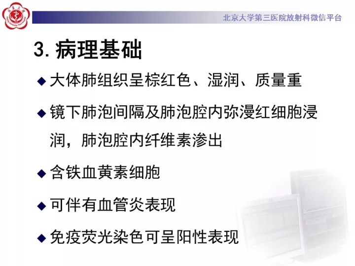 【病例】弥漫性肺泡出血1例CT影像表现