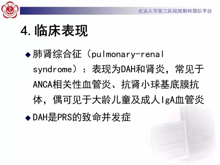 【病例】弥漫性肺泡出血1例CT影像表现