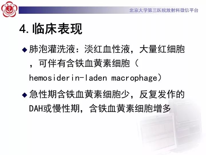 【病例】弥漫性肺泡出血1例CT影像表现