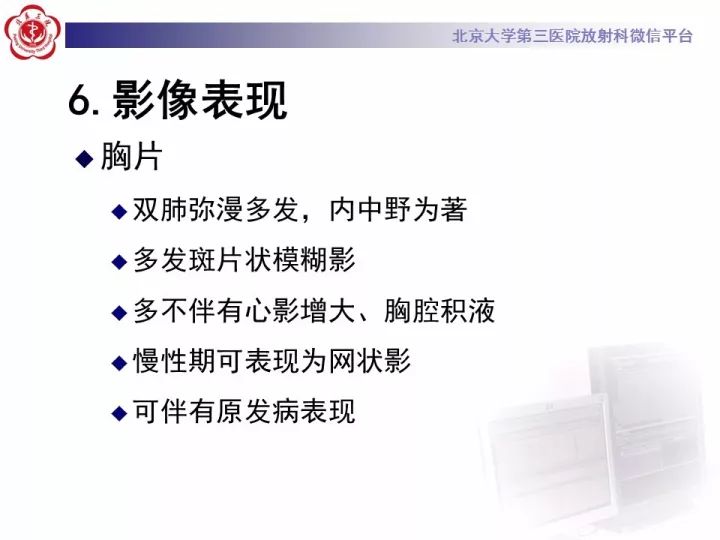 【病例】弥漫性肺泡出血1例CT影像表现
