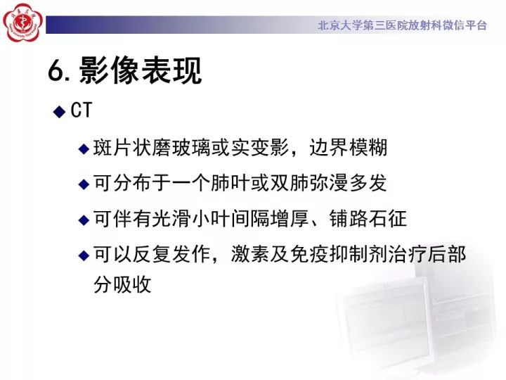 【病例】弥漫性肺泡出血1例CT影像表现