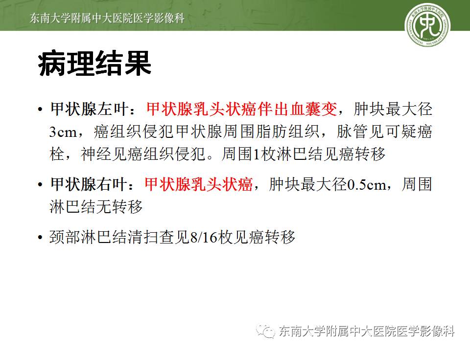 【病例】甲状腺乳头状癌1例CT影像诊断
