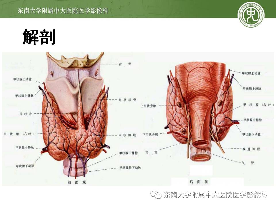 【病例】甲状腺乳头状癌1例CT影像诊断