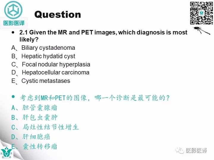 【病例】肝包虫囊肿1例CT及MR