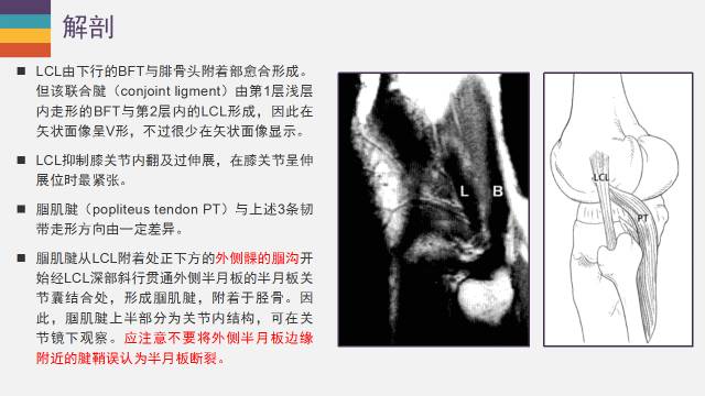 【PPT】膝关节外侧副韧带及外侧支持带解剖及损伤MR诊断