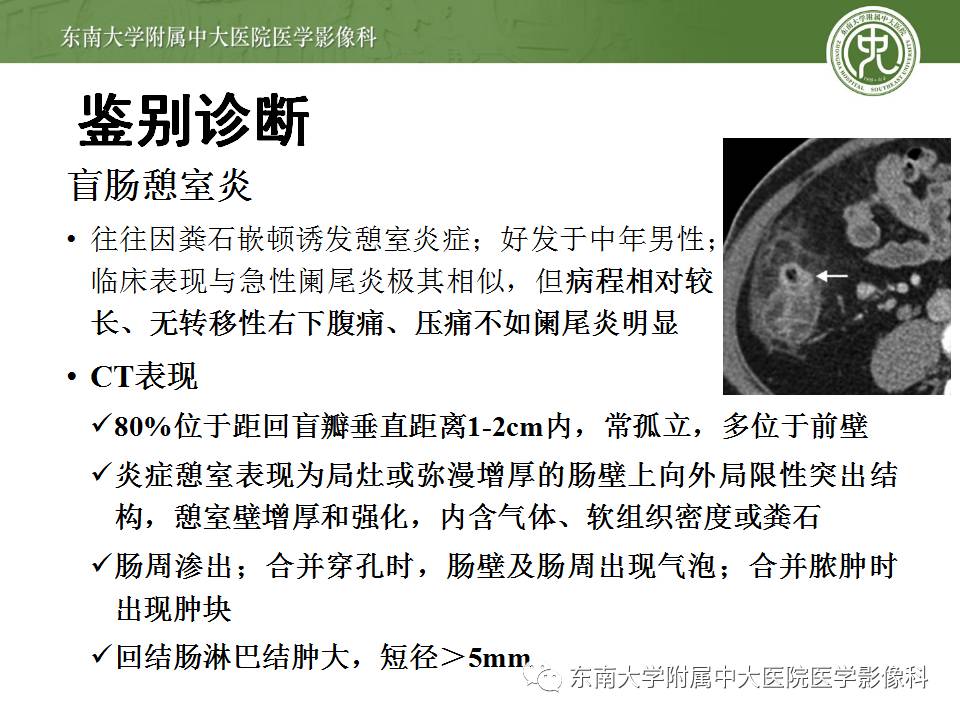【病例】阑尾炎1例CT影像表现