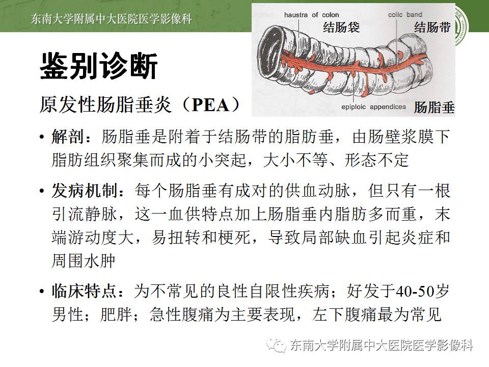 【病例】阑尾炎1例CT影像表现