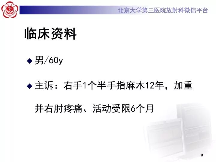 【病例】肘管综合征1例MR影像表现
