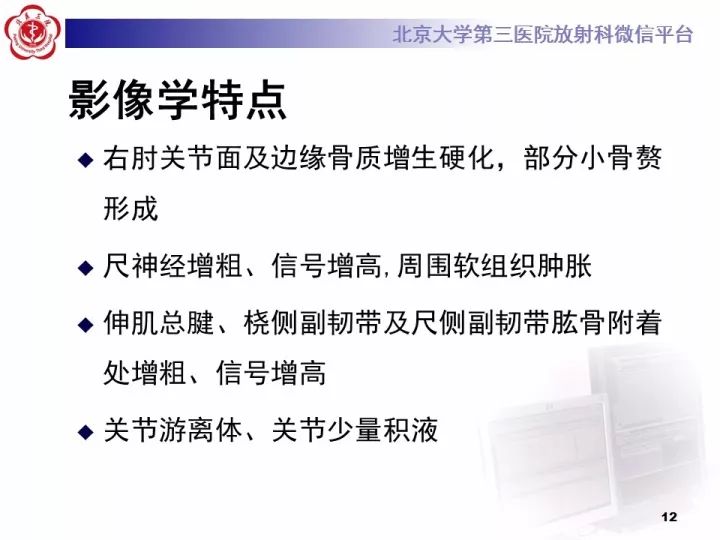 【病例】肘管综合征1例MR影像表现