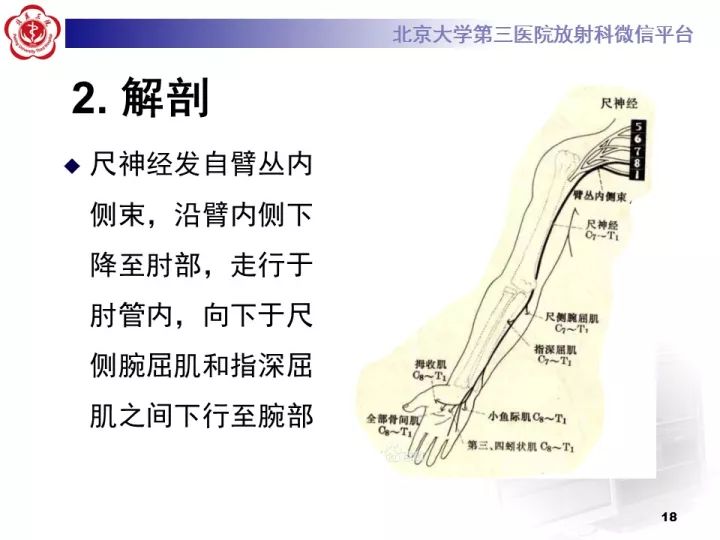 【病例】肘管综合征1例MR影像表现