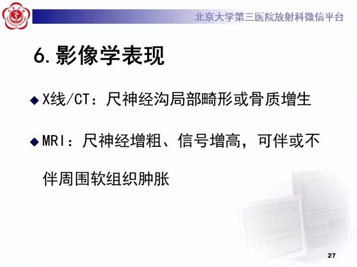 【病例】肘管综合征1例MR影像表现