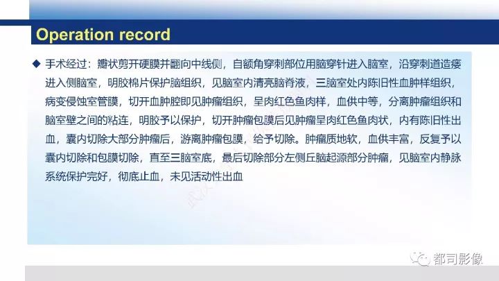 【病例】巨细胞胶质母细胞瘤1例CT及MR影像诊断