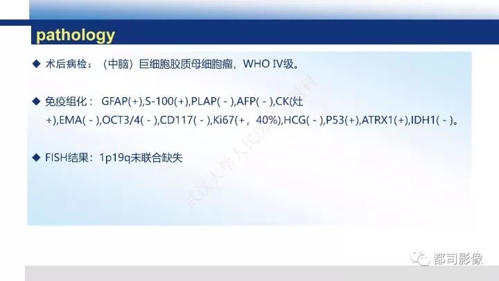 【病例】巨细胞胶质母细胞瘤1例CT及MR影像诊断
