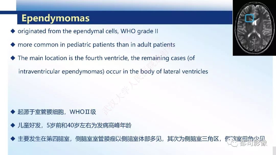 【病例】巨细胞胶质母细胞瘤1例CT及MR影像诊断