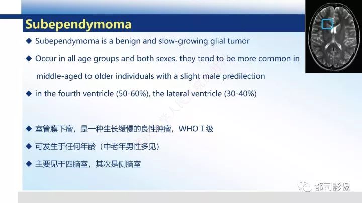 【病例】巨细胞胶质母细胞瘤1例CT及MR影像诊断