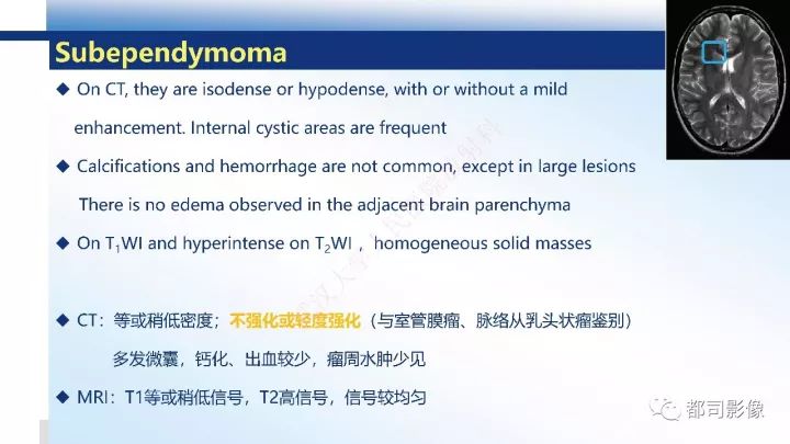 【病例】巨细胞胶质母细胞瘤1例CT及MR影像诊断