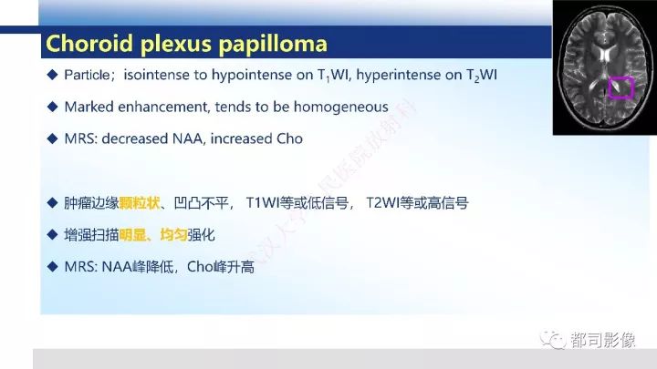 【病例】巨细胞胶质母细胞瘤1例CT及MR影像诊断