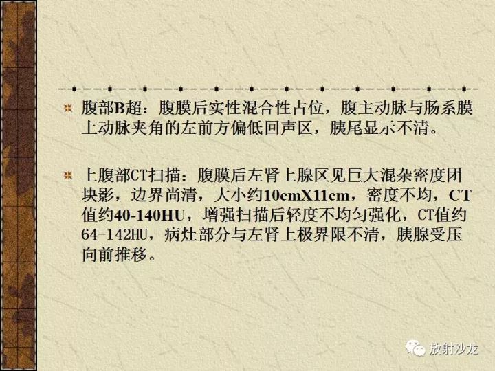 【病例】腹膜后PNET一例CT影像表现