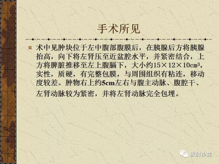 【病例】腹膜后PNET一例CT影像表现