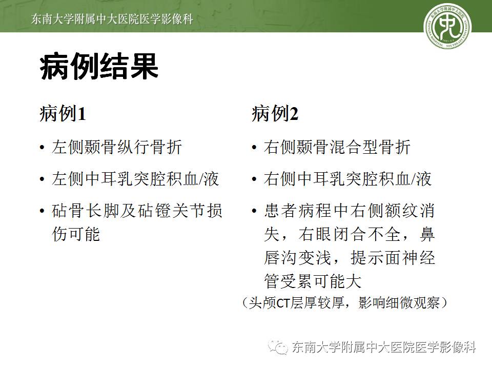 【病例】颞骨骨折2例影像诊断 【病例】颞骨骨折2例影像诊断