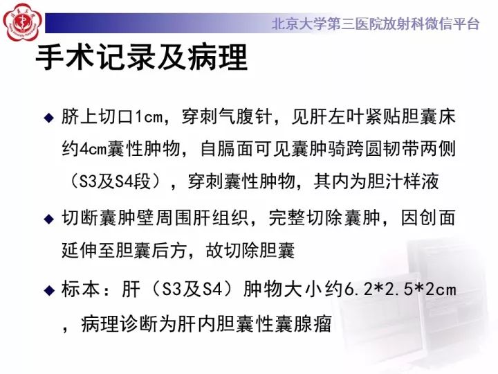 【病例】肝内胆管囊腺瘤1例CT及MR影像诊断