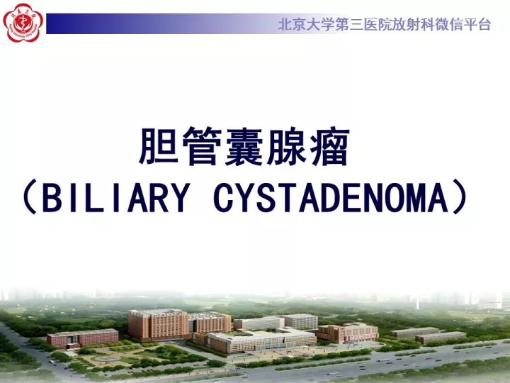 【病例】肝内胆管囊腺瘤1例CT及MR影像诊断