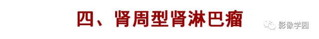 【病例】肾脏恶性淋巴瘤1例MR影像诊断 【病例】肾脏恶性淋巴瘤1例MR影像诊断