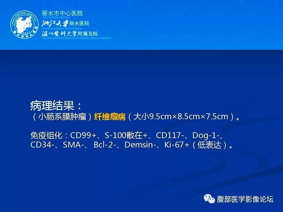 【病例】小肠系膜纤维瘤病1例CT