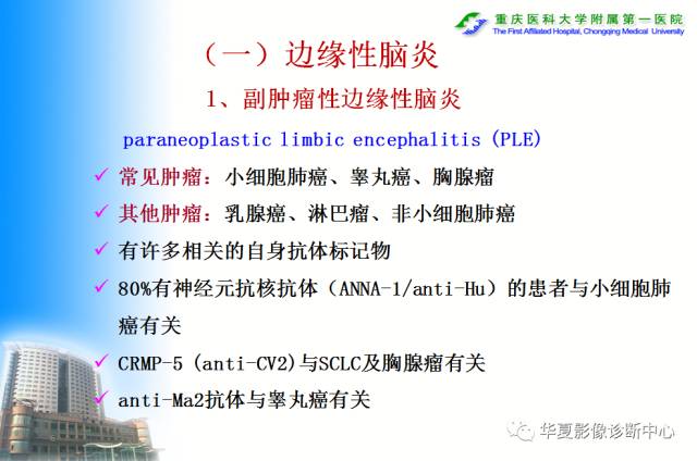 【PPT】自身免疫性脑病的影像学诊断