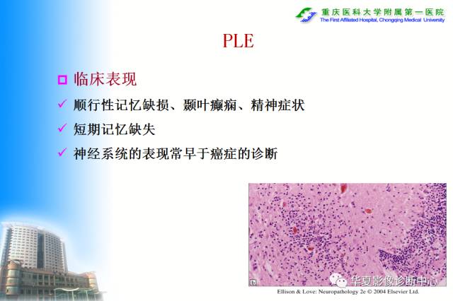 【PPT】自身免疫性脑病的影像学诊断