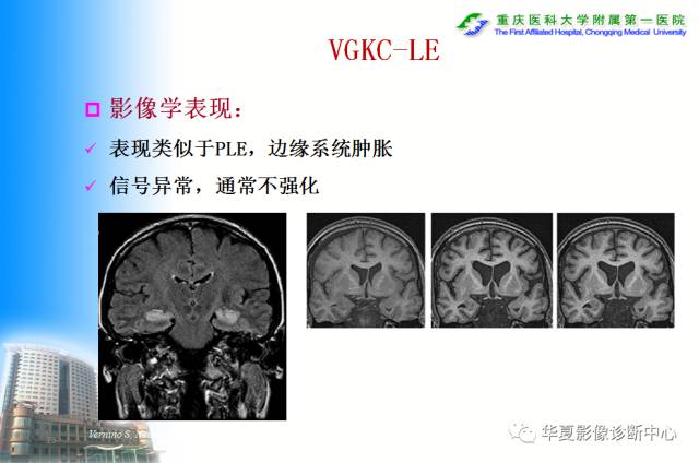 【PPT】自身免疫性脑病的影像学诊断