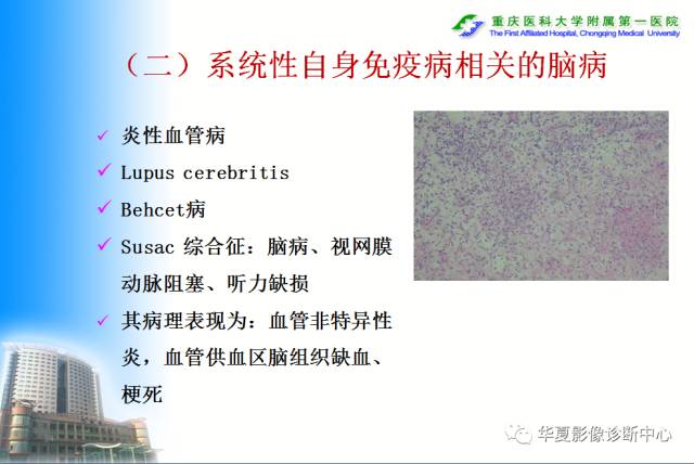 【PPT】自身免疫性脑病的影像学诊断