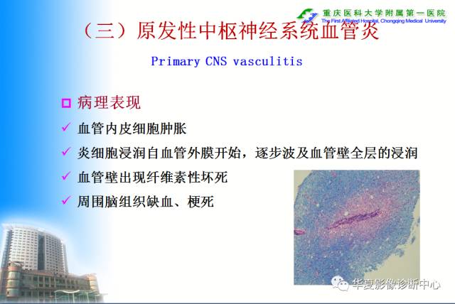 【PPT】自身免疫性脑病的影像学诊断