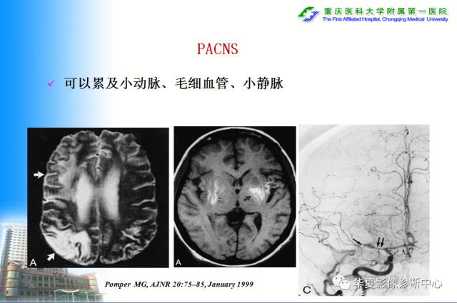 【PPT】自身免疫性脑病的影像学诊断