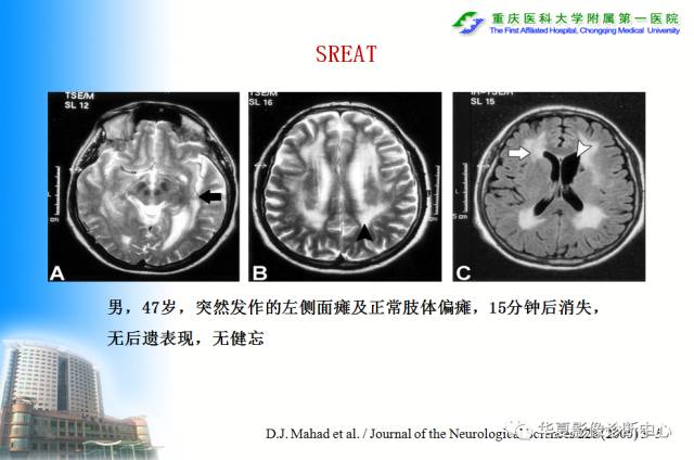 【PPT】自身免疫性脑病的影像学诊断