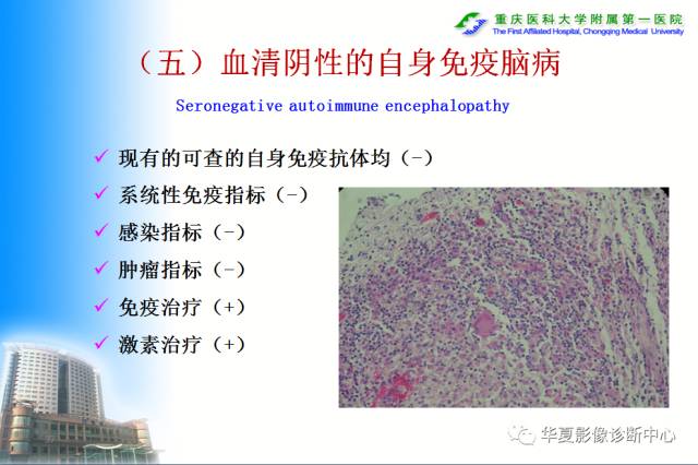 【PPT】自身免疫性脑病的影像学诊断