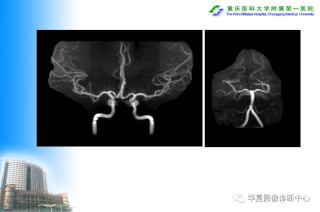 【PPT】自身免疫性脑病的影像学诊断