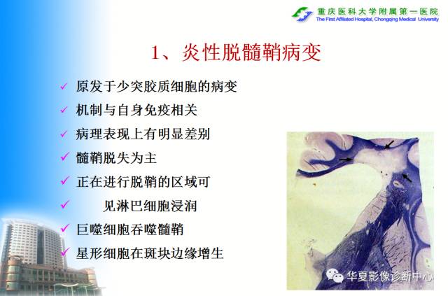 【PPT】自身免疫性脑病的影像学诊断